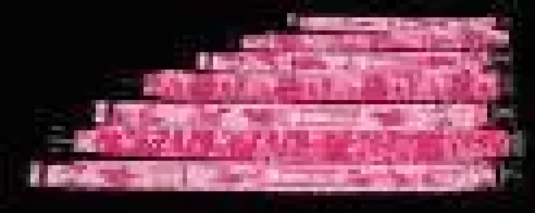 EzyDog Neopren Halsbånd XXL Pink Camouflage 66-70 cm